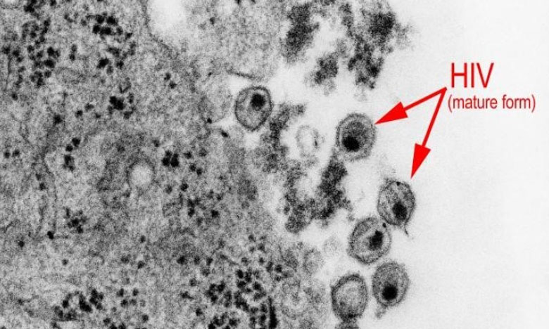 Cientista portuguesa descobre mecanismo das células resistentes ao HIV