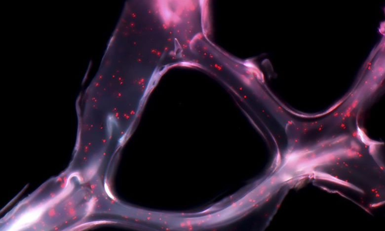 Foto de terapia inovadora para cancro desenvolvida por português premiada