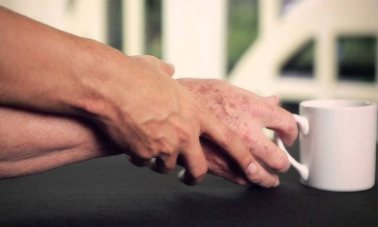 Investigadores lusos criam aplicação que deteta sinais de Parkinson