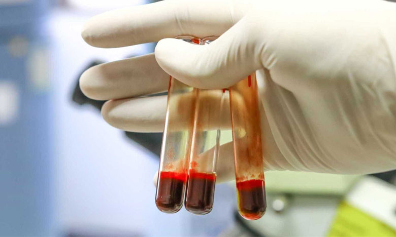 Investigadores lusos descobrem células que sinalizam doenças autoimunes