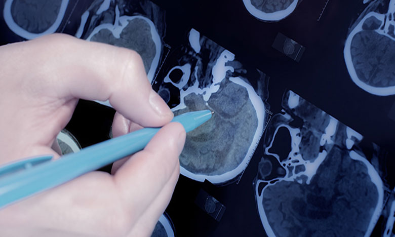 Investigadores portugueses descobrem moléculas que podem retardar doença de Parkinson