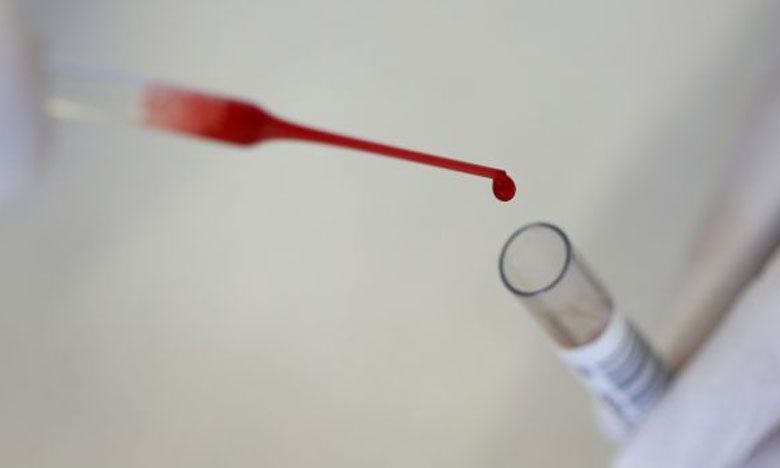 Novo teste sanguíneo identifica localização de cancro