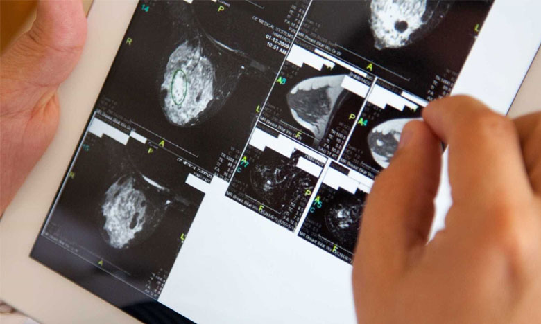Software criado no Porto auxilia na cirurgia de reconstrução mamária
