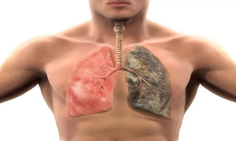 Transplantes pulmonares põem Portugal no top mundial