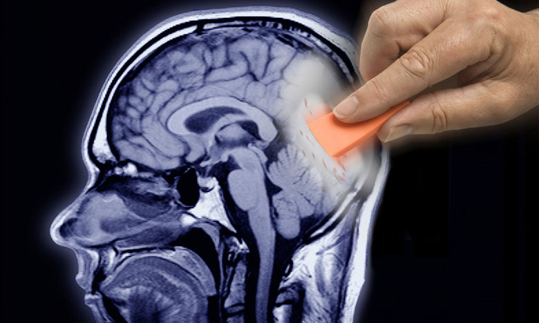 Universidade de Évora lidera equipa que cria moléculas tratar Alzheimer