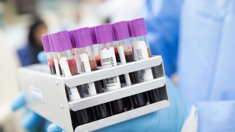 Emigrante português tem cancro raro e o seu ADN pode ajudar