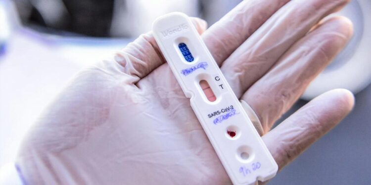 Covid-19: Testes rápidos vendidos nas farmácias a partir de hoje 11 Covid-19: Testes rápidos vendidos nas farmácias