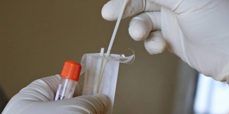 Portugal entrega 60 000 testes PCR a Cabo Verde, Guiné-Bissau e São Tomé e Príncipe 11 testes PCR