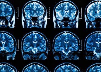 Cientistas portugueses identificam região cerebral com potencial de alteração precoce por Alzheimer 13 Cientistas portugueses identificam região cerebral com potencial de alteração precoce por Alzheimer
