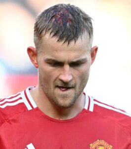 Arrepiante: Joelhada deixou jogador com a cabeça neste estado 19 Arrepiante: Joelhada deixou jogador com a cabeça neste estado